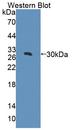 ACACB / ACC2 Antibody - Western Blot; Sample: Recombinant protein encoding aa 29-249.
