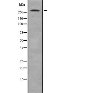 ACACB / ACC2 Antibody - Western blot analysis of ACACB using MCF-7 whole lysates.