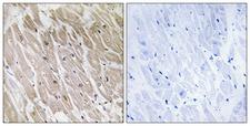 ACAD10 Antibody - Immunohistochemistry analysis of paraffin-embedded human heart, using ACAD10 Antibody. The picture on the right is blocked with the synthesized peptide.