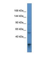ACAD10 Antibody - Western blot of Human 293T. ACAD10 antibody dilution 1.0 ug/ml.  This image was taken for the unconjugated form of this product. Other forms have not been tested.