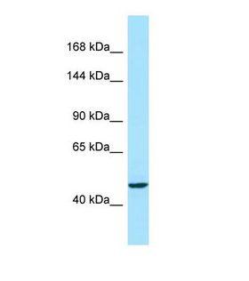 ACAD10 Antibody - Western blot of Human MCF7. ACAD10 antibody dilution 1.0 ug/ml.  This image was taken for the unconjugated form of this product. Other forms have not been tested.