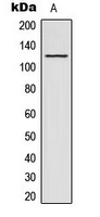 ACAD10 Antibody - Western blot analysis of ACAD10 expression in HeLa (A) whole cell lysates.