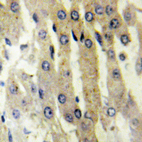 ACAD10 Antibody - Immunohistochemical analysis of ACAD10 staining in human liver formalin fixed paraffin embedded tissue section. The section was pre-treated using heat mediated antigen retrieval with sodium citrate buffer (pH 6.0). The section was then incubated with the antibody at room temperature and detected using an HRP conjugated compact polymer system. DAB was used as the chromogen. The section was then counterstained with hematoxylin and mounted with DPX.