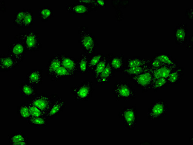 ACAD11 Antibody - Immunofluorescent analysis of HepG2 Cells at a dilution of 1:100 and Alexa Fluor 488-congugated AffiniPure Goat Anti-Rabbit IgG(H+L)