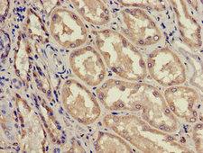 ACAD11 Antibody - Immunohistochemistry image of paraffin-embedded human kidney tissue at a dilution of 1:100