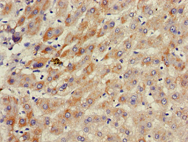 ACAD11 Antibody - Immunohistochemistry image of paraffin-embedded human liver tissue at a dilution of 1:100