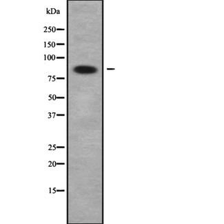 ACAD11 Antibody - Western blot analysis of ACAD11 using Jurkat whole cells lysates