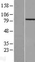 ACAD11 Protein - Western validation with an anti-DDK antibody * L: Control HEK293 lysate R: Over-expression lysate
