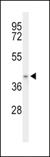 ACAD8 Antibody - Western blot of ACAD8 Antibody in mouse stomach tissue lysates (35 ug/lane). ACAD8 (arrow) was detected using the purified antibody.