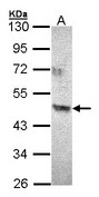 ACAD8 Antibody - Sample (30 ug of whole cell lysate). A:293T. 10% SDS PAGE. ACAD8 antibody diluted at 1:500