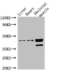 ACAD8 Antibody - Western Blot Positive WB detected in: Mouse liver tissue, Mouse heart tissue, Mouse skeletal muscle tissue All lanes: ACAD8 antibody at 3µg/ml Secondary Goat polyclonal to rabbit IgG at 1/50000 dilution Predicted band size: 46, 32, 39 kDa Observed band size: 46, 39 kDa