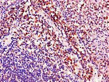 ACAD8 Antibody - Immunohistochemistry of paraffin-embedded human tonsil tissue using ACAD8 Antibody at dilution of 1:100