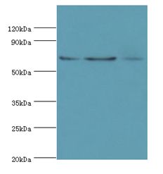 ACAD9 Antibody - Western blot. All lanes: ACAD9 antibody at 6 ug/ml. Lane 1: MCF-7 whole cell lysate. Lane 2: 293T whole cell lysate. Lane 3: K562 whole cell lysate. Secondary antibody: Goat polyclonal to rabbit at 1:10000 dilution. Predicted band size: 69 kDa. Observed band size: 69 kDa.