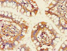 ACAD9 Antibody - Immunohistochemistry of paraffin-embedded human small intestine tissue using antibody at 1:100 dilution.
