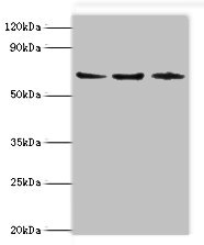 ACAD9 Antibody - Western blot All lanes: ACAD9 antibody at 6µg/ml Lane 1: MCF-7 whole cell lysate Lane 2: 293T whole cell lysate Lane 3: K562 whole cell lysate Secondary Goat polyclonal to rabbit IgG at 1/10000 dilution Predicted band size: 69 kDa Observed band size: 69 kDa