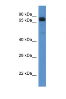 ACAD9 Antibody - ACAD9 antibody Western blot of 721_B Cell lysate. Antibody concentration 1 ug/ml.  This image was taken for the unconjugated form of this product. Other forms have not been tested.