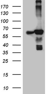 ACAD9 Antibody - HEK293T cells were transfected with the pCMV6-ENTRY control. (Left lane) or pCMV6-ENTRY ACAD9. (Right lane) cDNA for 48 hrs and lysed. Equivalent amounts of cell lysates. (5 ug per lane) were separated by SDS-PAGE and immunoblotted with anti-ACAD9. (1:2000)