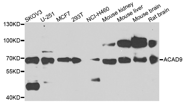 ACAD9 Antibody - Western blot analysis of extracts of various cells.