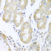ACAD9 Antibody - Immunohistochemistry of paraffin-embedded human stomach tissue.