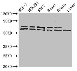 ACAD9 Antibody - Western Blot Positive WB detected in:MCF-7 whole cell lysate,HEK293 whole cell lysate,K562 whole cell lysate,Mouse heart tissue,Mouse brain tissue,Mouse liver tissue All Lanes:ACAD9 antibody at 1µg/ml Secondary Goat polyclonal to rabbit IgG at 1/50000 dilution Predicted band size: 69 KDa Observed band size: 69,70 KDa