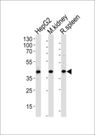 ACADL Antibody - Western blot of lysates from HepG2 cell line and mouse kidney, rat spleen tissue lysates(from left to right), using ACADL Antibody. Antibody was diluted at 1:1000 at each lane. A goat anti-rabbit IgG H&L (HRP) at 1:5000 dilution was used as the secondary antibody. Lysates at 35ug per lane.