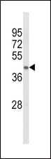 ACADL Antibody - Western blot of ACADL Antibody in mouse kidney tissue lysates (35 ug/lane). ACADL (arrow) was detected using the purified antibody.