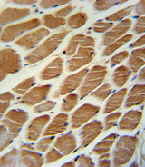 ACADL Antibody - ACADL Antibody immunohistochemistry of formalin-fixed and paraffin-embedded human skeletal muscle followed by peroxidase-conjugated secondary antibody and DAB staining.