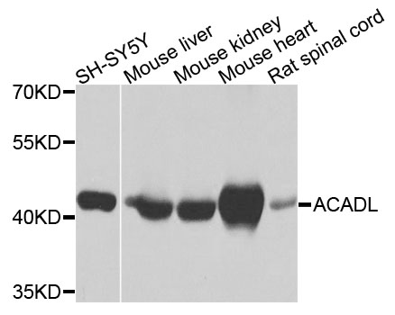 ACADL Antibody - Western blot analysis of extracts of various cell lines, using ACADL antibody at 1:1000 dilution. The secondary antibody used was an HRP Goat Anti-Rabbit IgG (H+L) at 1:10000 dilution. Lysates were loaded 25ug per lane and 3% nonfat dry milk in TBST was used for blocking. An ECL Kit was used for detection and the exposure time was 1s.