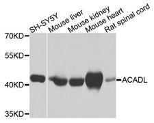 ACADL Antibody - Western blot analysis of extracts of various cell lines, using ACADL antibody at 1:1000 dilution. The secondary antibody used was an HRP Goat Anti-Rabbit IgG (H+L) at 1:10000 dilution. Lysates were loaded 25ug per lane and 3% nonfat dry milk in TBST was used for blocking. An ECL Kit was used for detection and the exposure time was 1s.