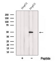 ACADL Antibody - Western blot analysis of extracts of HepG2 cells using ACADL antibody. The lane on the left was treated with blocking peptide.