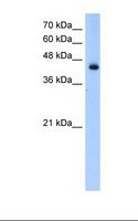 ACADL Antibody - Transfected 293T cell lysate. Antibody concentration: 0.25 ug/ml. Gel concentration: 12%.  This image was taken for the unconjugated form of this product. Other forms have not been tested.