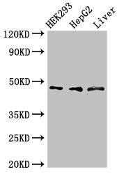 ACADSB Antibody - Western Blot Positive WB detected in:HEK293 whole cell lysate,HepG2 whole cell lysate,Rat liver tissue All Lanes:ACADSB antibody at 3µg/ml Secondary Goat polyclonal to rabbit IgG at 1/50000 dilution Predicted band size: 48,37 KDa Observed band size: 48 KDa