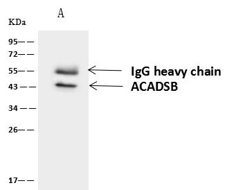 ACADSB Antibody - ACADSB was immunoprecipitated using: Lane A: 0.5 mg HepG2 Whole Cell Lysate. 4 uL anti-ACADSB rabbit polyclonal antibody and 60 ug of Immunomagnetic beads Protein A/G. Primary antibody: Anti-ACADSB rabbit polyclonal antibody, at 1:100 dilution. Secondary antibody: Goat Anti-Rabbit IgG (H+L)/HRP at 1/10000 dilution. Developed using the ECL technique. Performed under reducing conditions. Predicted band size: 47 kDa. Observed band size: 43 kDa.