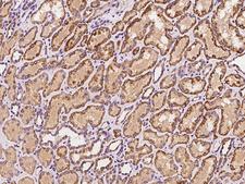 ACADSB Antibody - Immunochemical staining of human ACADSB in human kidney with rabbit polyclonal antibody at 1:100 dilution, formalin-fixed paraffin embedded sections.