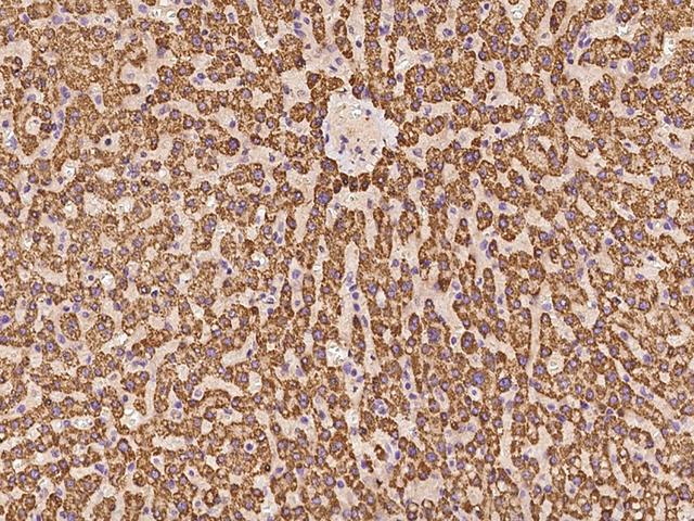 ACADSB Antibody - Immunochemical staining of human ACADSB in human liver with rabbit polyclonal antibody at 1:100 dilution, formalin-fixed paraffin embedded sections.