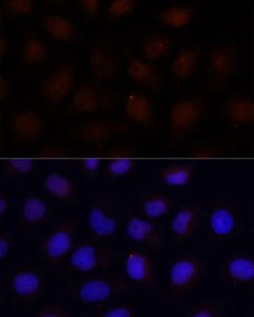 ACADSB Antibody - Immunofluorescence analysis of HeLa cells using ACADSB Polyclonal Antibody at dilution of 1:100 (40x lens).Blue: DAPI for nuclear staining.