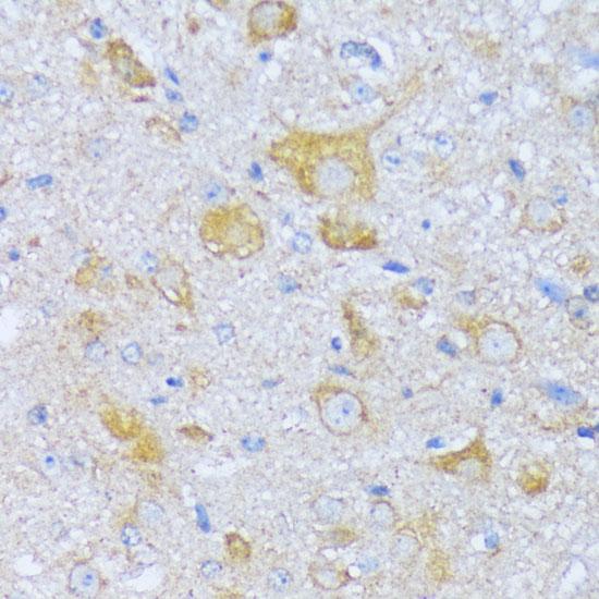 ACADSB Antibody - Immunohistochemistry of paraffin-embedded Mouse spinal cord using ACADSB Polyclonal Antibody at dilution of 1:100 (40x lens).