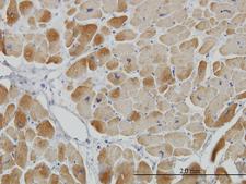 ACADVL Antibody - Immunoperoxidase of monoclonal antibody to ACADVL on formalin-fixed paraffin-embedded human heart. [antibody concentration 3 ug/ml]