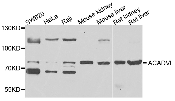 ACADVL Antibody - Western blot analysis of extracts of various cells.