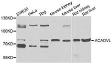 ACADVL Antibody - Western blot analysis of extracts of various cells.