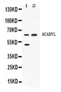 ACADVL Antibody - Western blot - Anti-ACADVL Picoband Antibody