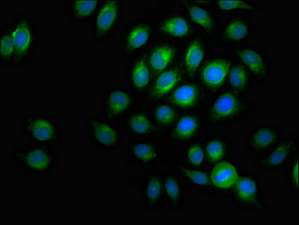 ACADVL Antibody - Immunofluorescent analysis of A549 cells a at a dilution of 1:100 and Alexa Fluor 488-congugated AffiniPure Goat Anti-Rabbit IgG(H+L)