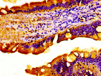 ACADVL Antibody - Immunohistochemistry image of paraffin-embedded human small intestine tissue at a dilution of 1:100