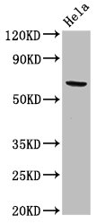 ACADVL Antibody - Positive Western Blot detected in Hela whole cell lysate. All lanes: ACADVL antibody at 2 µg/ml Secondary Goat polyclonal to rabbit IgG at 1/50000 dilution. Predicted band size: 71, 69, 73 KDa. Observed band size: 71 KDa