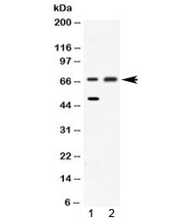 ACADVL Antibody - Western blot testing of 1) rat liver and 2) HeLa lysate with ACADVL antibody at 0.5ug/ml. Predicted molecular weight: 68-70 kDa.