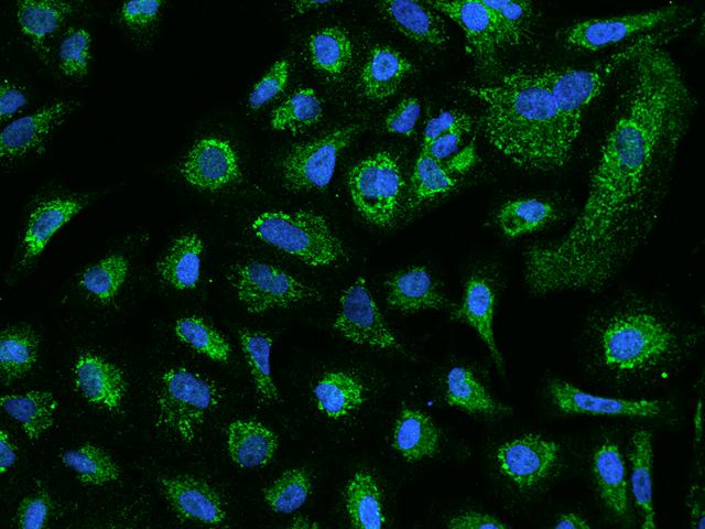 ACADVL Antibody - Immunofluorescence staining of ACADVL in A549 cells. Cells were fixed with 4% PFA, permeabilzed with 0.1% Triton X-100 in PBS, blocked with 10% serum, and incubated with rabbit anti-Human ACADVL polyclonal antibody (dilution ratio 1:200) at 4°C overnight. Then cells were stained with the Alexa Fluor 488-conjugated Goat Anti-rabbit IgG secondary antibody (green) and counterstained with DAPI (blue). Positive staining was localized to Cytoplasm.