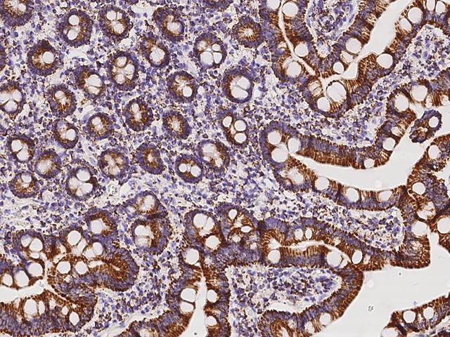 ACADVL Antibody - Immunochemical staining of human ACADVL in human duodenum with rabbit polyclonal antibody at 1:10000 dilution, formalin-fixed paraffin embedded sections.