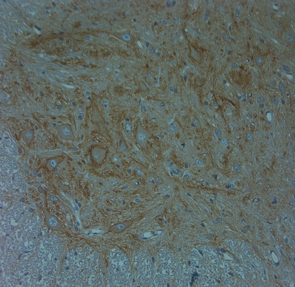 ACAN / Aggrecan Antibody - Rabbit antibody to Aggrecan (200-250). IHC on paraffin sections of mouse spinal cord tissue using Rabbit antibody to Aggrecan (200-250). HIER: 1 mM EDTA, pH 8 for 20 min using Thermo PT Module. Blocking: 0.2% LFDM in TBST filtered through a 0.2 micron filter. Detection was done using Novolink HRP polymer from Leica following manufacturer\'s instructions. Primary antibody: dilution 1:1000, incubated 30 min at RT (using Autostainer) Sections were counterstained with Harris Hematoxylin.