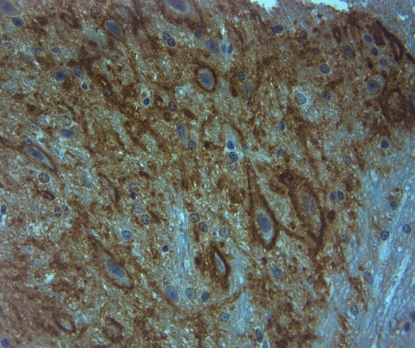 ACAN / Aggrecan Antibody - Rabbit antibody to Aggrecan (200-250). IHC on paraffin sections of mouse spinal cord tissue using Rabbit antibody to Aggrecan (200-250). HIER: 1 mM EDTA, pH 8 for 20 min using Thermo PT Module. Blocking: 0.2% LFDM in TBST filtered through a 0.2 micron filter. Detection was done using Novolink HRP polymer from Leica following manufacturer\'s instructions. Primary antibody: dilution 1:1000, incubated 30 min at RT (using Autostainer) Sections were counterstained with Harris Hematoxylin.
