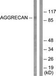 ACAN / Aggrecan Antibody - Western blot of extracts from Jurkat cells, treated with Etoposide 25 uM 60', using Aggrecan (Cleaved-Asp369) Antibody. The lane on the right is treated with the synthesized peptide.